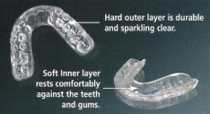 Custom Comfort Night Guard for Bruxism or "Night-Grinding" (Upper OR Lower)